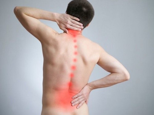 Thoát vị đĩa đệm là gì? Dấu hiệu cảnh báo