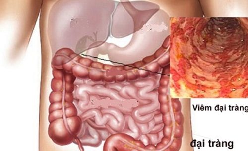 Các trụ cột trong mô hình điều trị tích hợp tại Thu Cúc