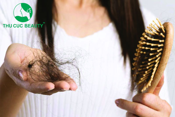 Ưu điểm khi điều trị rụng tóc nội tiết tại Bệnh viện Thu Cúc
