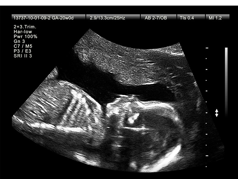 Siêu âm 4D tại Bệnh viện Hồng Ngọc có gì đặc biệt?