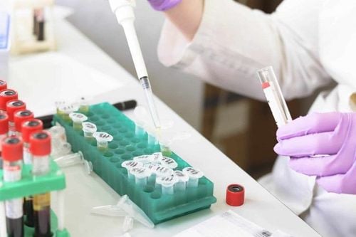Xét nghiệm IgE định lượng tại Bệnh viện Thu Cúc có gì khác biệt?