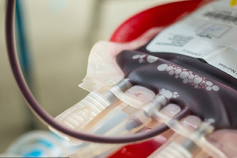 Tầm quan trọng của nội soi trong chẩn đoán và điều trị bệnh lý dạ dày
