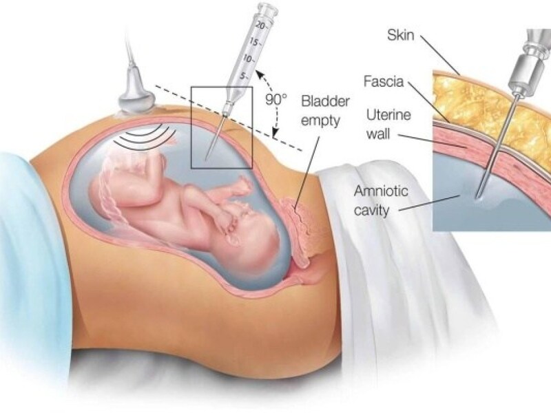Tầm quan trọng của nội soi trong chẩn đoán và điều trị bệnh lý dạ dày