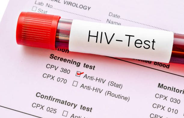 Ưu điểm khi xét nghiệm HIV tại Bệnh viện Hồng Ngọc