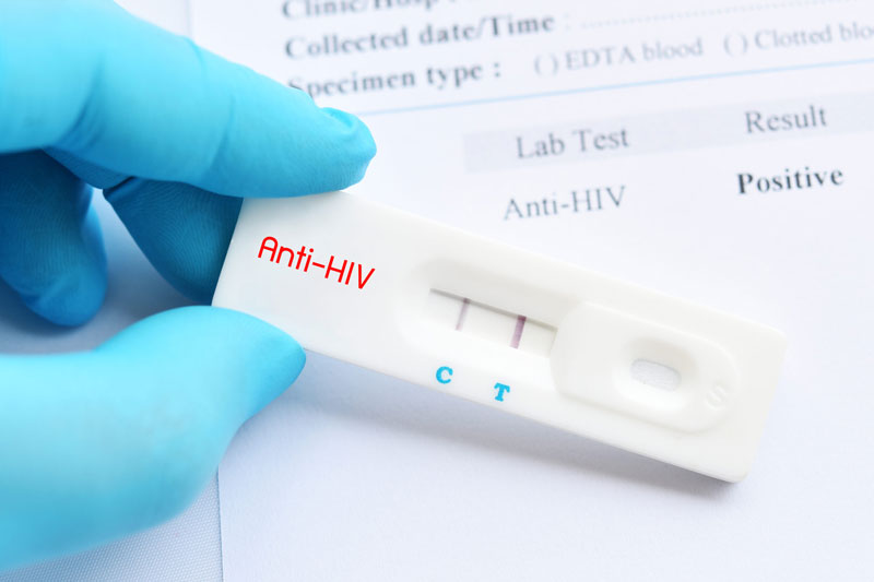 HIV là gì và vì sao cần xét nghiệm?