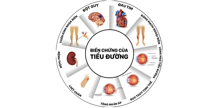 Tầm quan trọng của nội soi trong chẩn đoán và điều trị bệnh lý dạ dày