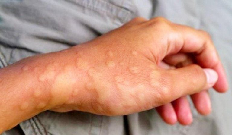 Tầm quan trọng của nội soi trong chẩn đoán và điều trị bệnh lý dạ dày