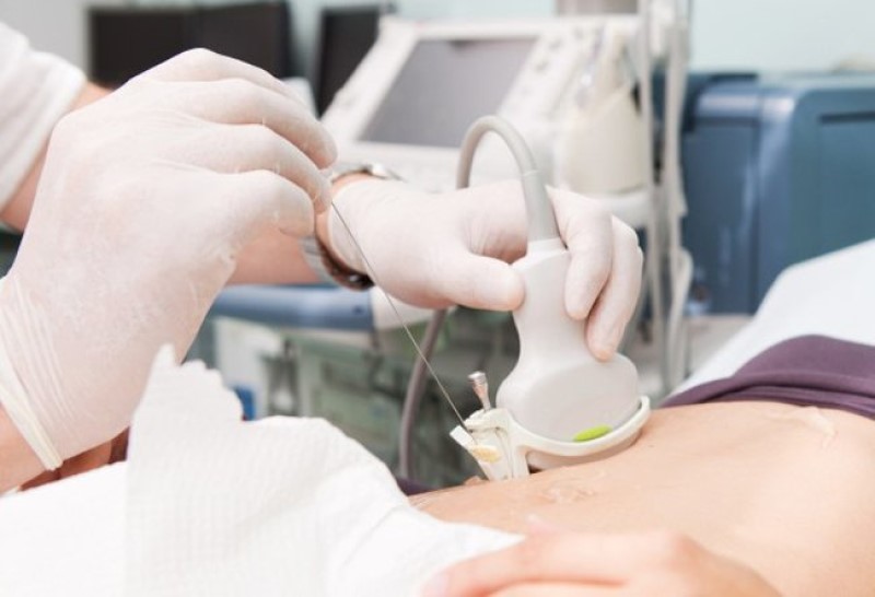 Những xét nghiệm cần thiết cho bệnh nhân viêm gan B