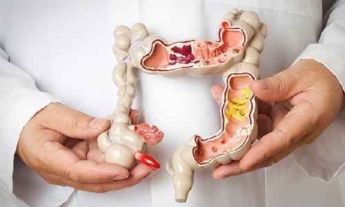 Ung thư đường tiêu hóa – mối nguy không thể chủ quan