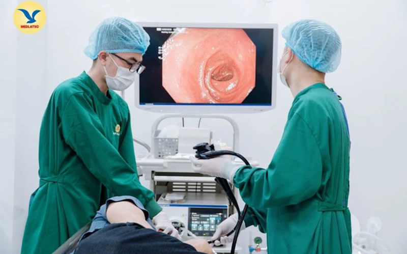 Tầm quan trọng của nội soi trong chẩn đoán và điều trị bệnh lý dạ dày