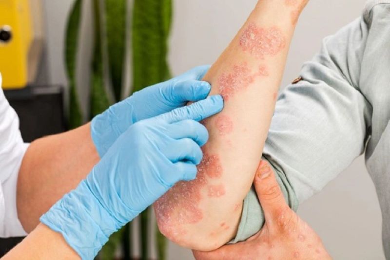 Tầm quan trọng của nội soi trong chẩn đoán và điều trị bệnh lý dạ dày