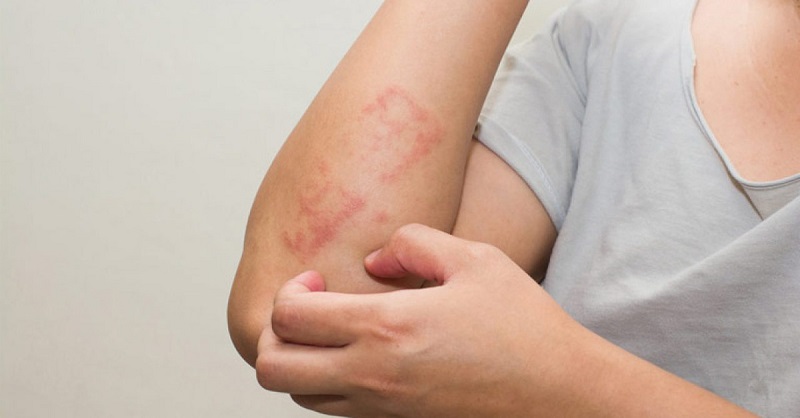 Điều trị đúng ngay từ đầu: Yếu tố quyết định hiệu quả