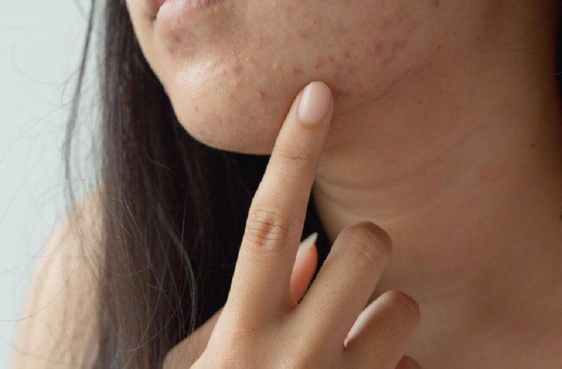 Tầm quan trọng của nội soi trong chẩn đoán và điều trị bệnh lý dạ dày