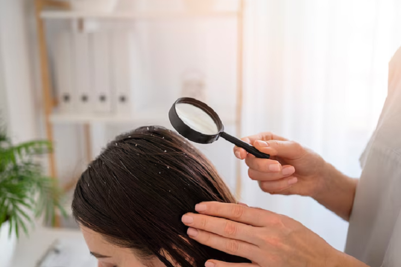 Rụng tóc do rối loạn nội tiết là gì?