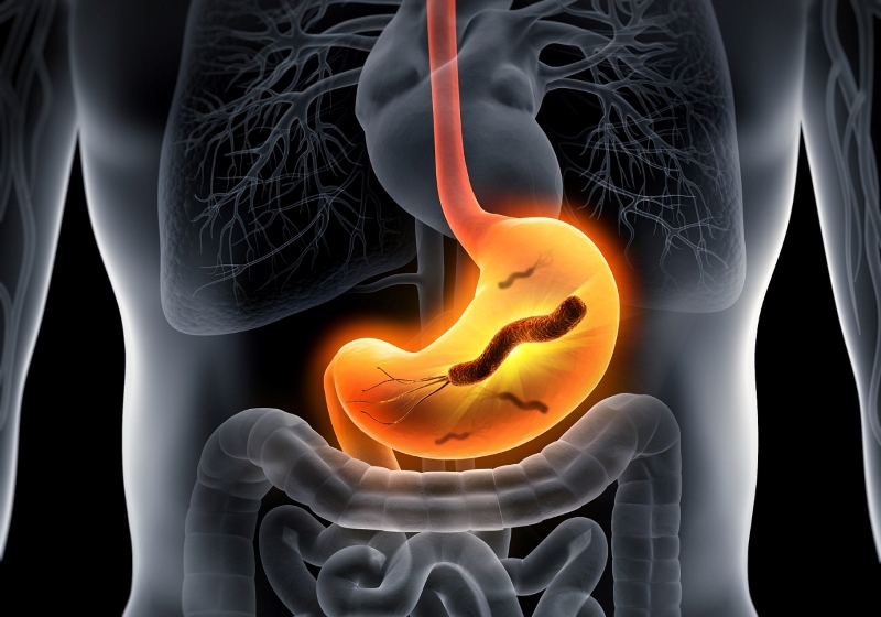 Ưu điểm khi điều trị đau dạ dày tại Medlatec
