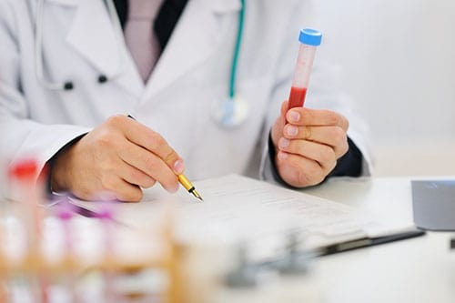 Xét nghiệm hormone sinh sản – Mấu chốt trong hành trình tìm con