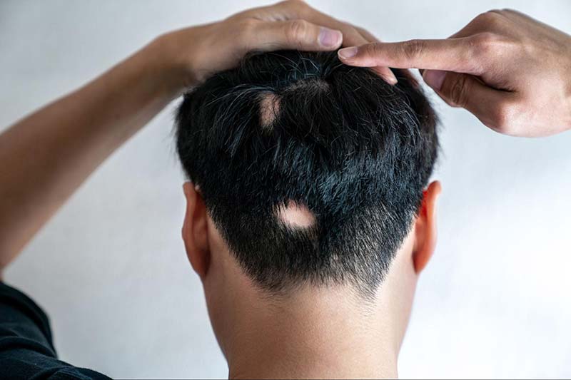 Tầm quan trọng của nội soi trong chẩn đoán và điều trị bệnh lý dạ dày