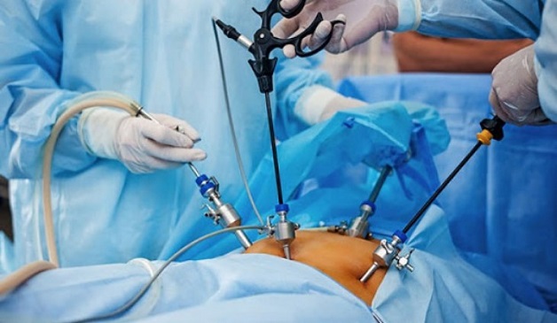Tầm quan trọng của nội soi trong chẩn đoán và điều trị bệnh lý dạ dày