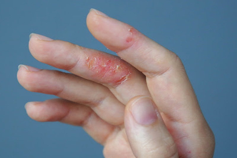Tầm quan trọng của nội soi trong chẩn đoán và điều trị bệnh lý dạ dày