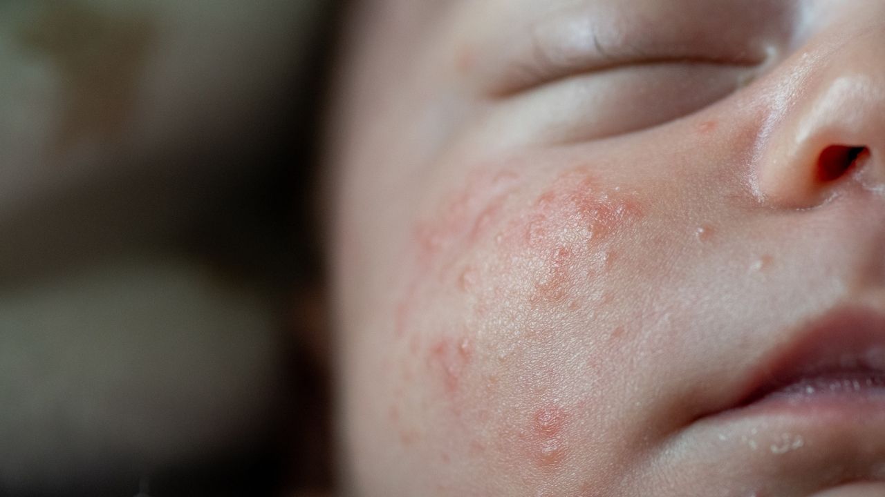 Tầm quan trọng của nội soi trong chẩn đoán và điều trị bệnh lý dạ dày