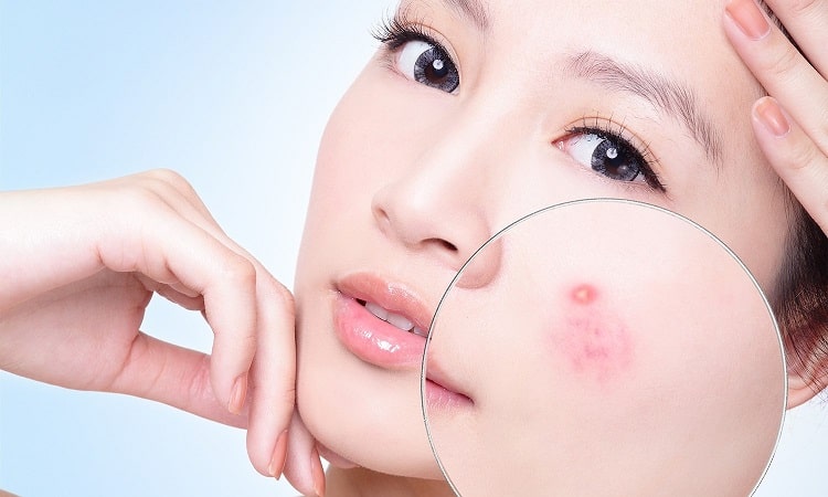Tầm quan trọng của nội soi trong chẩn đoán và điều trị bệnh lý dạ dày