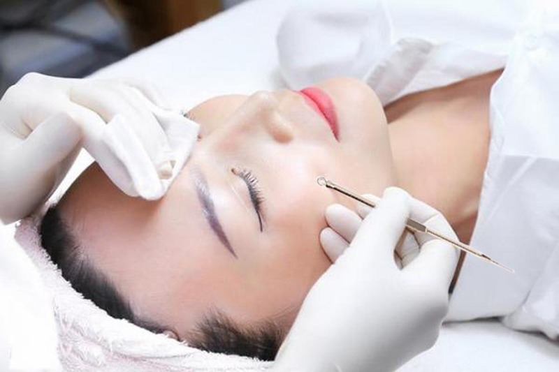 Mụn nội tiết – Nguyên nhân sâu xa từ bên trong