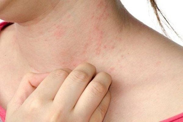 Quy trình khám và chẩn đoán tại chuyên khoa da liễu
