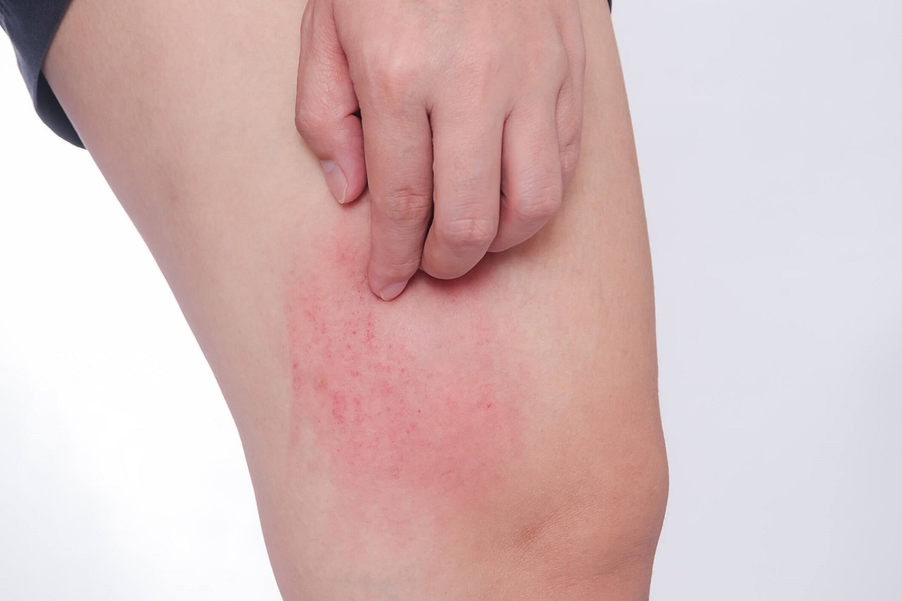 Tầm quan trọng của nội soi trong chẩn đoán và điều trị bệnh lý dạ dày