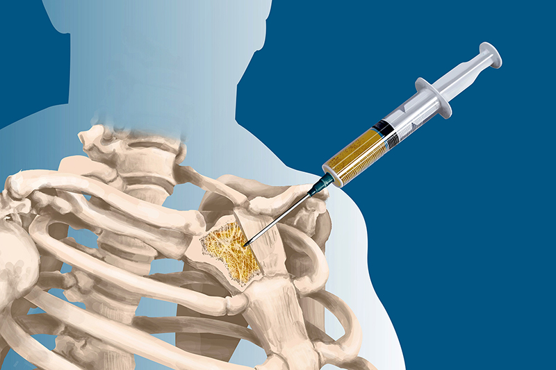 Tầm quan trọng của nội soi trong chẩn đoán và điều trị bệnh lý dạ dày