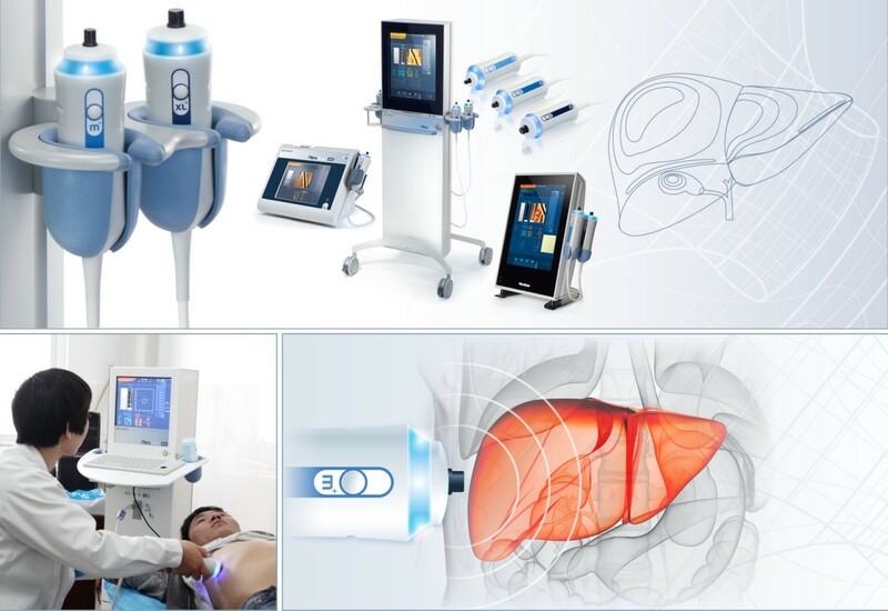 Tầm quan trọng của nội soi trong chẩn đoán và điều trị bệnh lý dạ dày