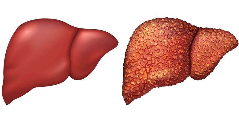 Tầm quan trọng của nội soi trong chẩn đoán và điều trị bệnh lý dạ dày