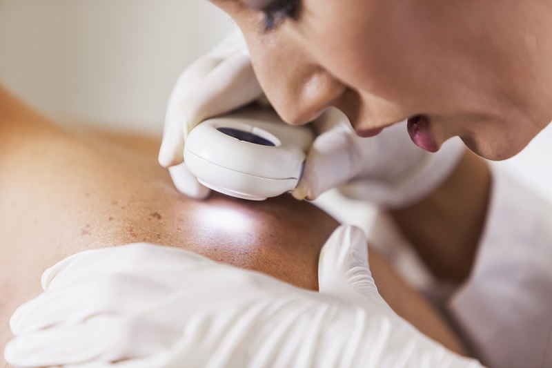 Các bệnh lý và dịch vụ điều trị da liễu tại Medlatec