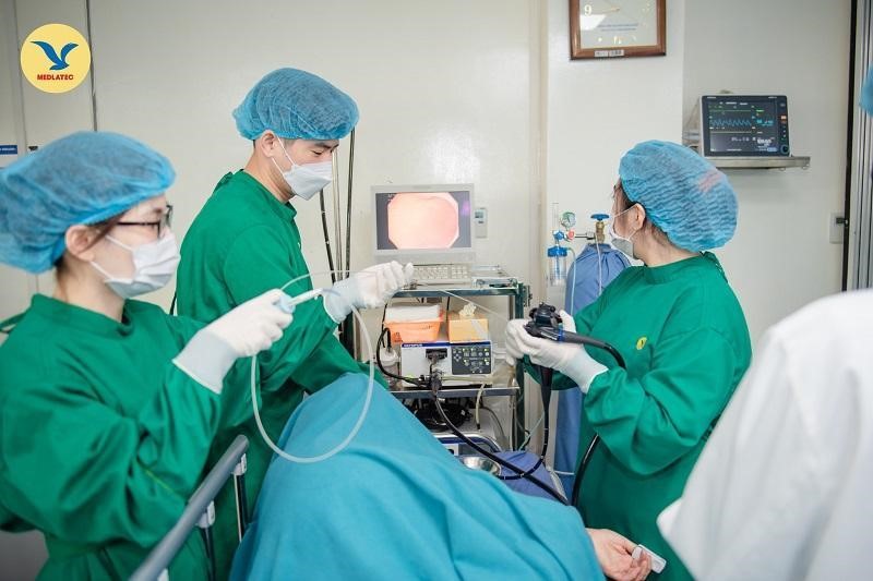 Nội soi tiêu hóa không đau là gì?