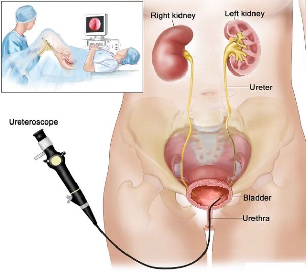 Tầm quan trọng của nội soi trong chẩn đoán và điều trị bệnh lý dạ dày