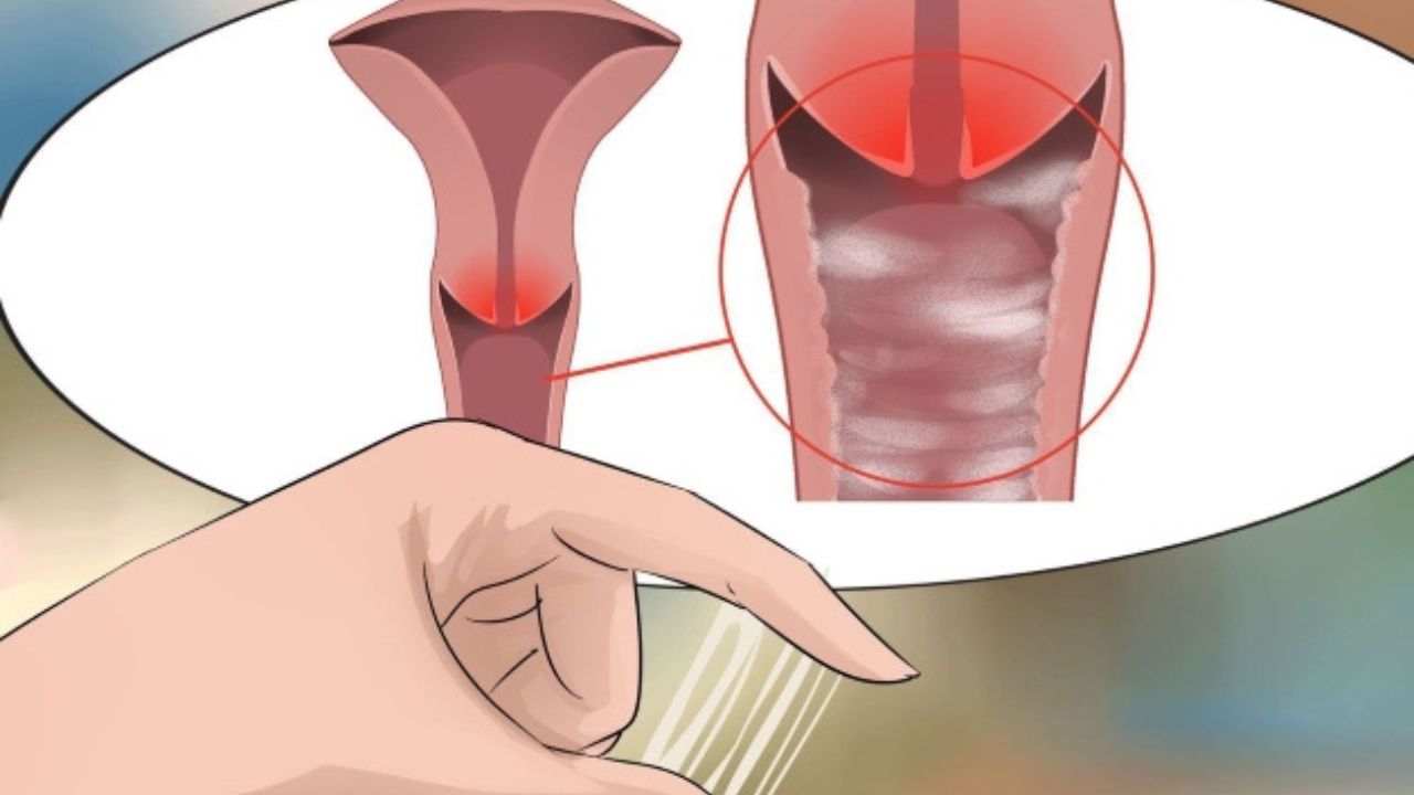 Tầm quan trọng của nội soi trong chẩn đoán và điều trị bệnh lý dạ dày