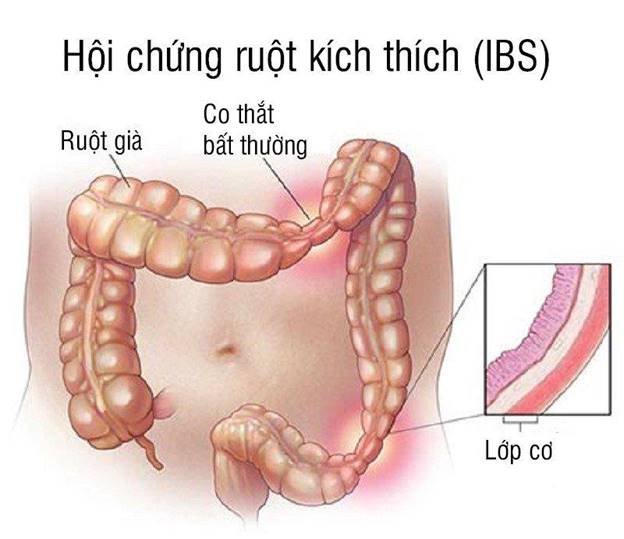 Tầm quan trọng của nội soi trong chẩn đoán và điều trị bệnh lý dạ dày
