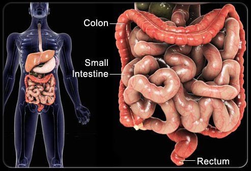 Bệnh viêm ruột (IBD) là gì?