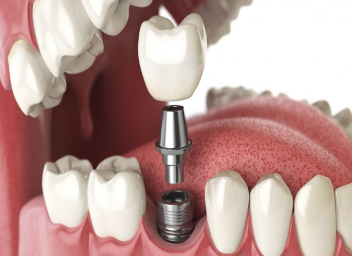 Đội ngũ b&aacute;c sĩ chuy&ecirc;n m&ocirc;n cao