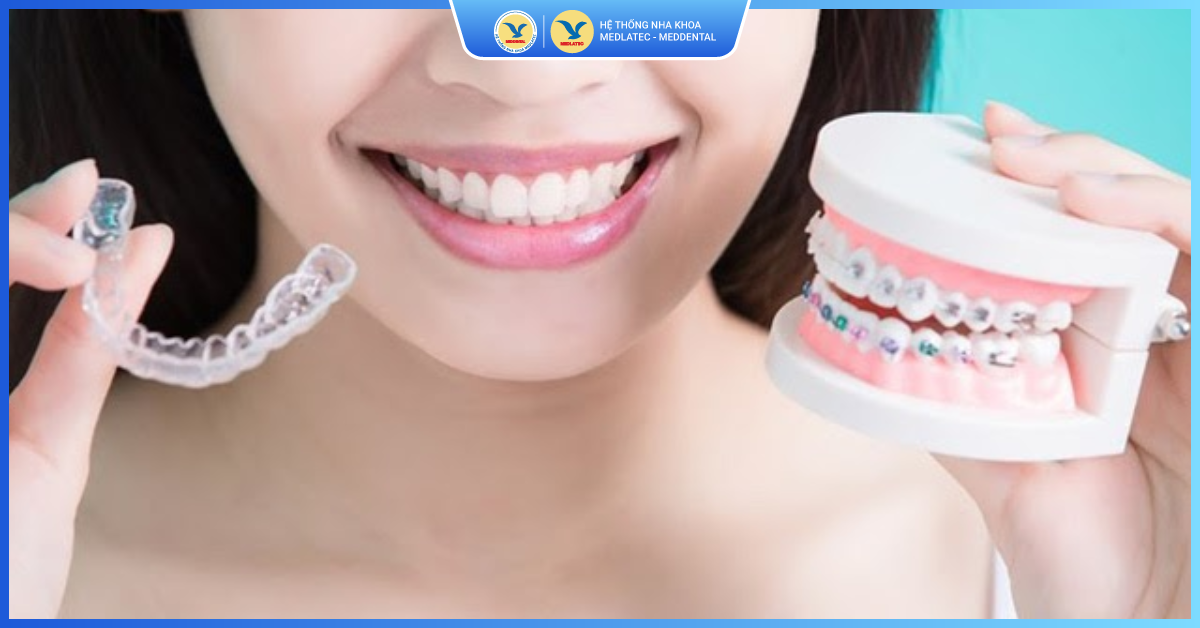 Nhu cầu chỉnh nha ngày càng tăng cao