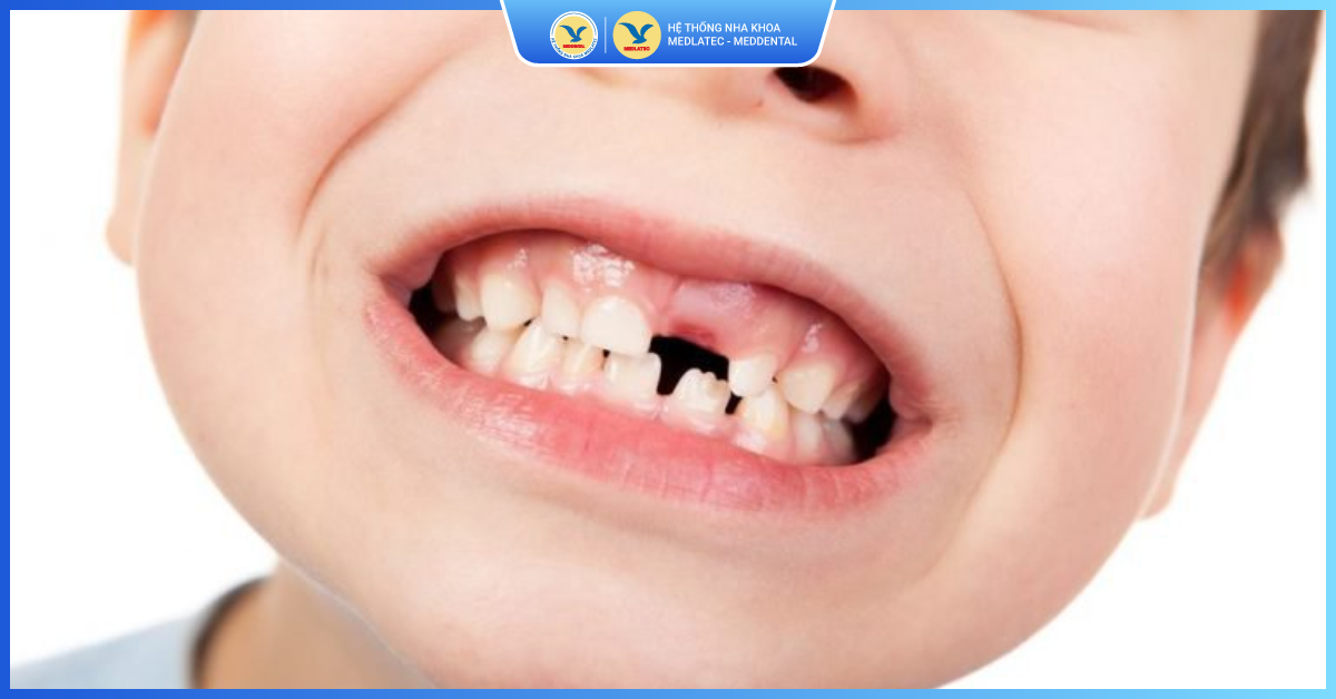 Tầm quan trọng của nội soi trong chẩn đoán và điều trị bệnh lý dạ dày