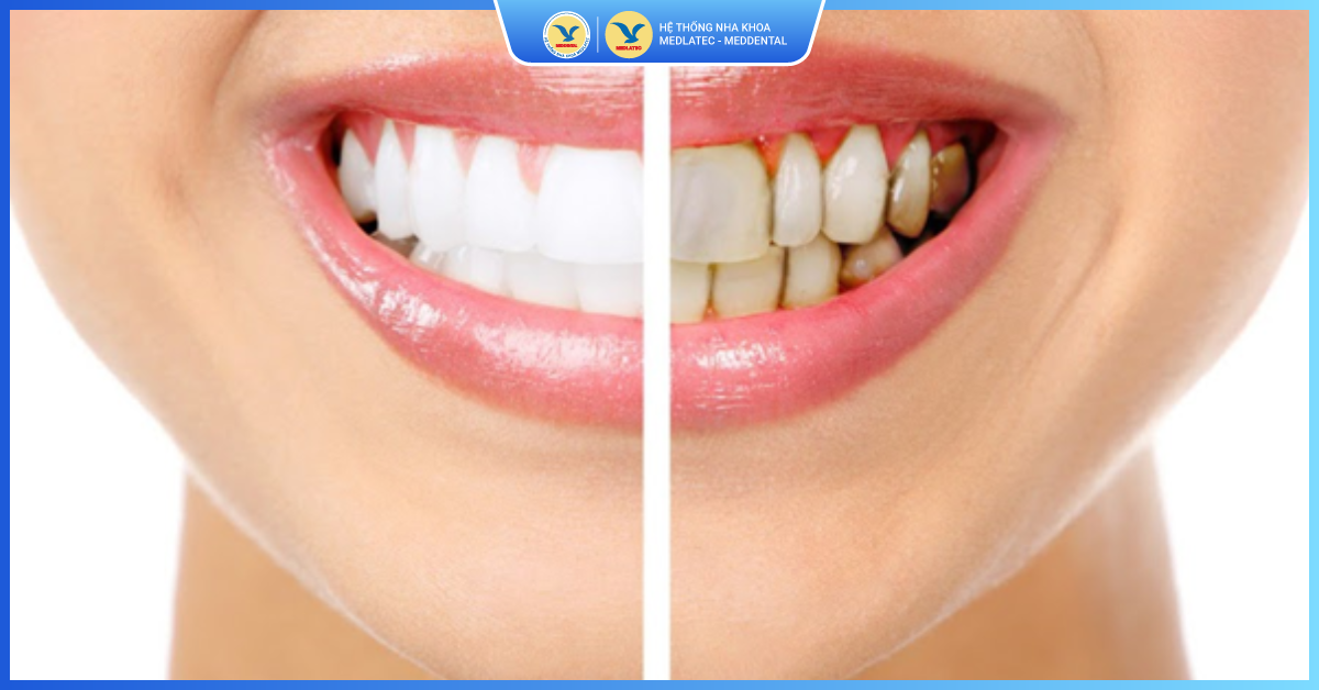 Tầm quan trọng của nội soi trong chẩn đoán và điều trị bệnh lý dạ dày