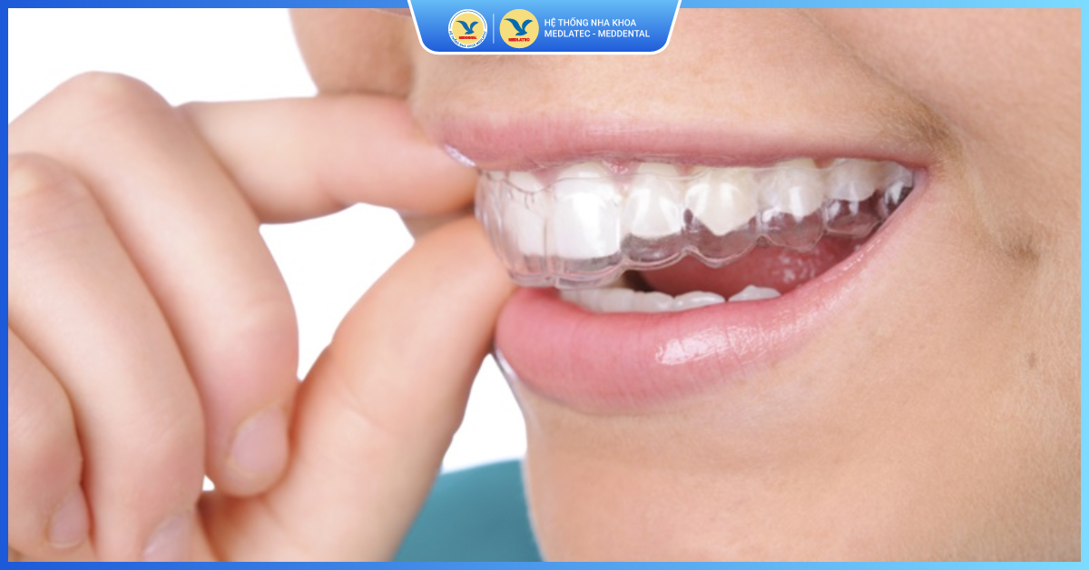 Tầm quan trọng của nội soi trong chẩn đoán và điều trị bệnh lý dạ dày