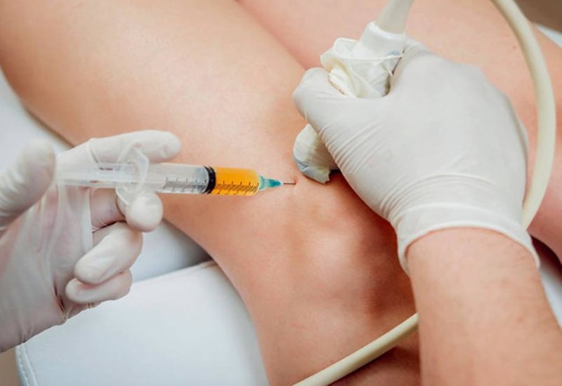 Tầm quan trọng của nội soi trong chẩn đoán và điều trị bệnh lý dạ dày