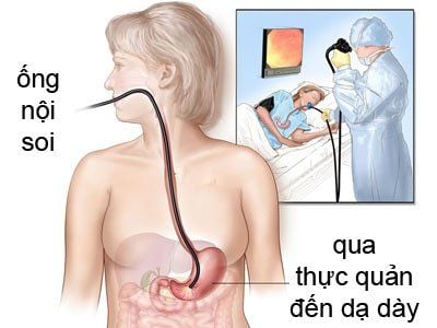 Nội soi tại Thu Cúc có an toàn không?