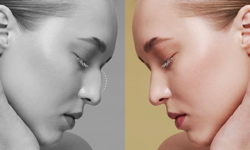 Vì sao phẫu thuật thẩm mỹ tại Bệnh viện Thu Cúc được quan tâm?