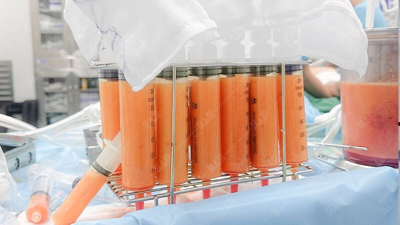 Tầm quan trọng của nội soi trong chẩn đoán và điều trị bệnh lý dạ dày