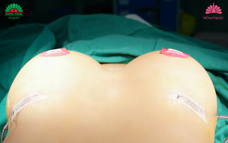 Tầm quan trọng của nội soi trong chẩn đoán và điều trị bệnh lý dạ dày