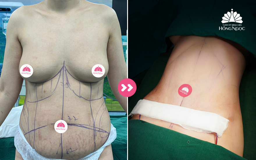 Tầm quan trọng của nội soi trong chẩn đoán và điều trị bệnh lý dạ dày