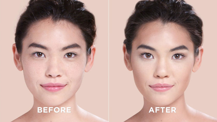 Tầm quan trọng của nội soi trong chẩn đoán và điều trị bệnh lý dạ dày