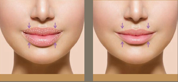 Tầm quan trọng của nội soi trong chẩn đoán và điều trị bệnh lý dạ dày